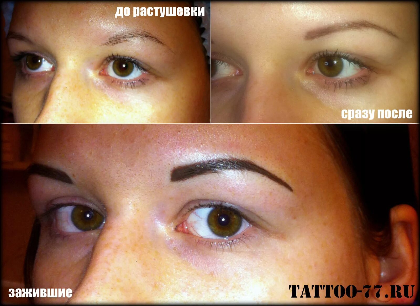 Перманентный макияж бровей гиперреализм. Исправление перманентного макияжа. Лазерное удаление перманентного макияжа бровей. Можно ли делать брови при онкологии. Татуаж бровей.