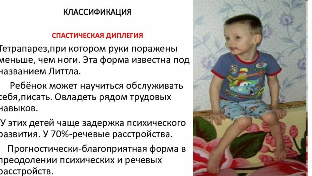 Тетрапарез что это. Спастический тетрапарез. центральный спастический тетрапарез. спастический тетрапарез конечностей. дцп у детей презентация.