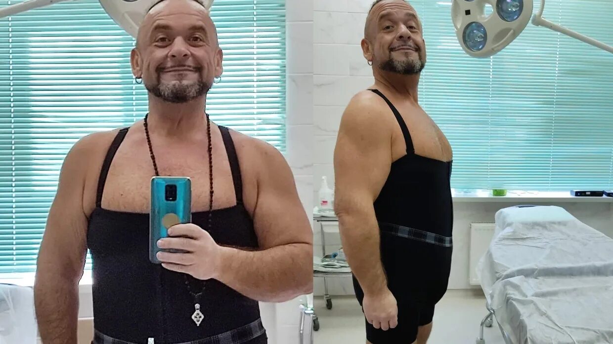 Холодный компресс на коленный сустав. Александр морозов юморист похудел. Холод после операции. Александр морозов 2021. Холодный компресс.