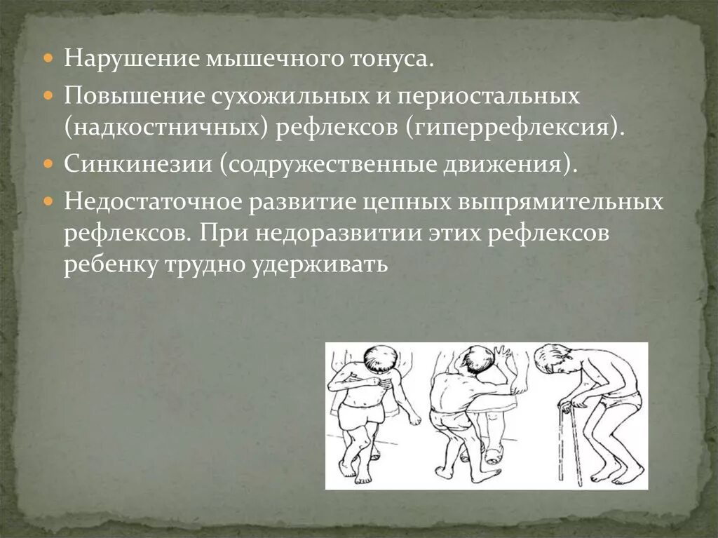 Расстройство мышечного тонуса. Расстройство мышечного тонуса. Гипотония мышечного тонуса. Синдром нарушения мышечного тонуса. Пониженный мышечный тонус.