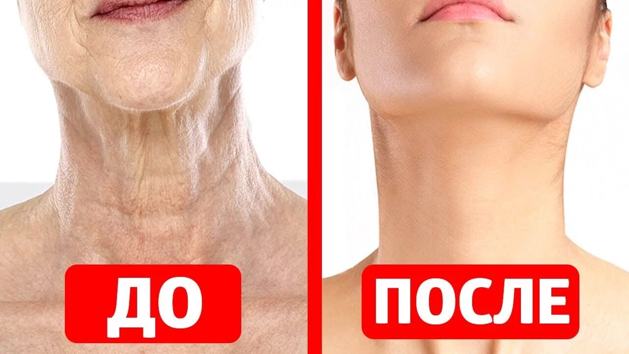 Шея обвисла после похудения. Дряблая шея и декольте. дряблость кожи на шеи и декольте.