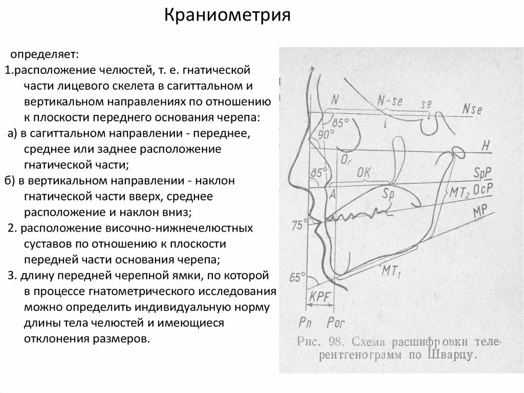 Основные краниометрические точки. Краниометрические показатели. Точки краниометрии на черепе. Оценка расположения челюстей в сагиттальном направлении.