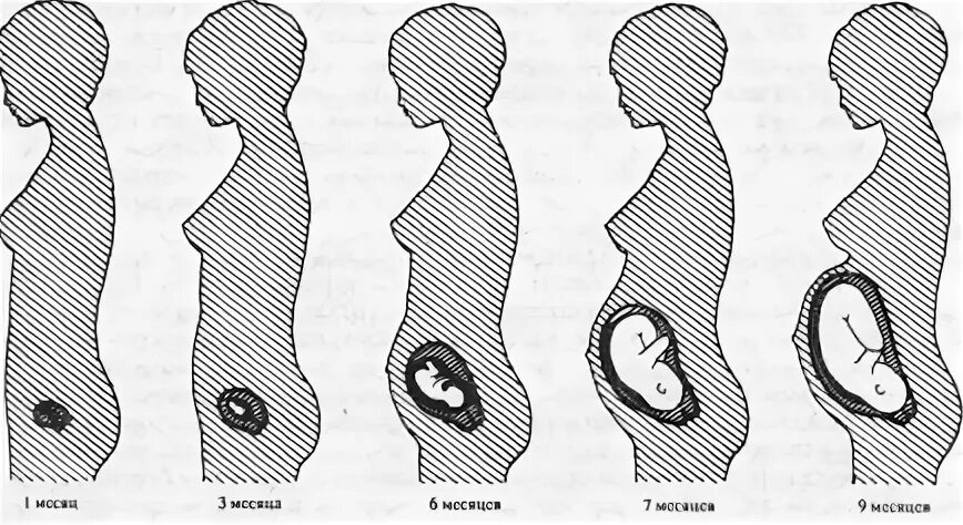 Размер живота на 10 неделе беременности. Матка на 2 месяце беременности. Размер матки на 10 неделе беременности. Матка в животе по неделям беременности. Беременна 1 месяц беременности