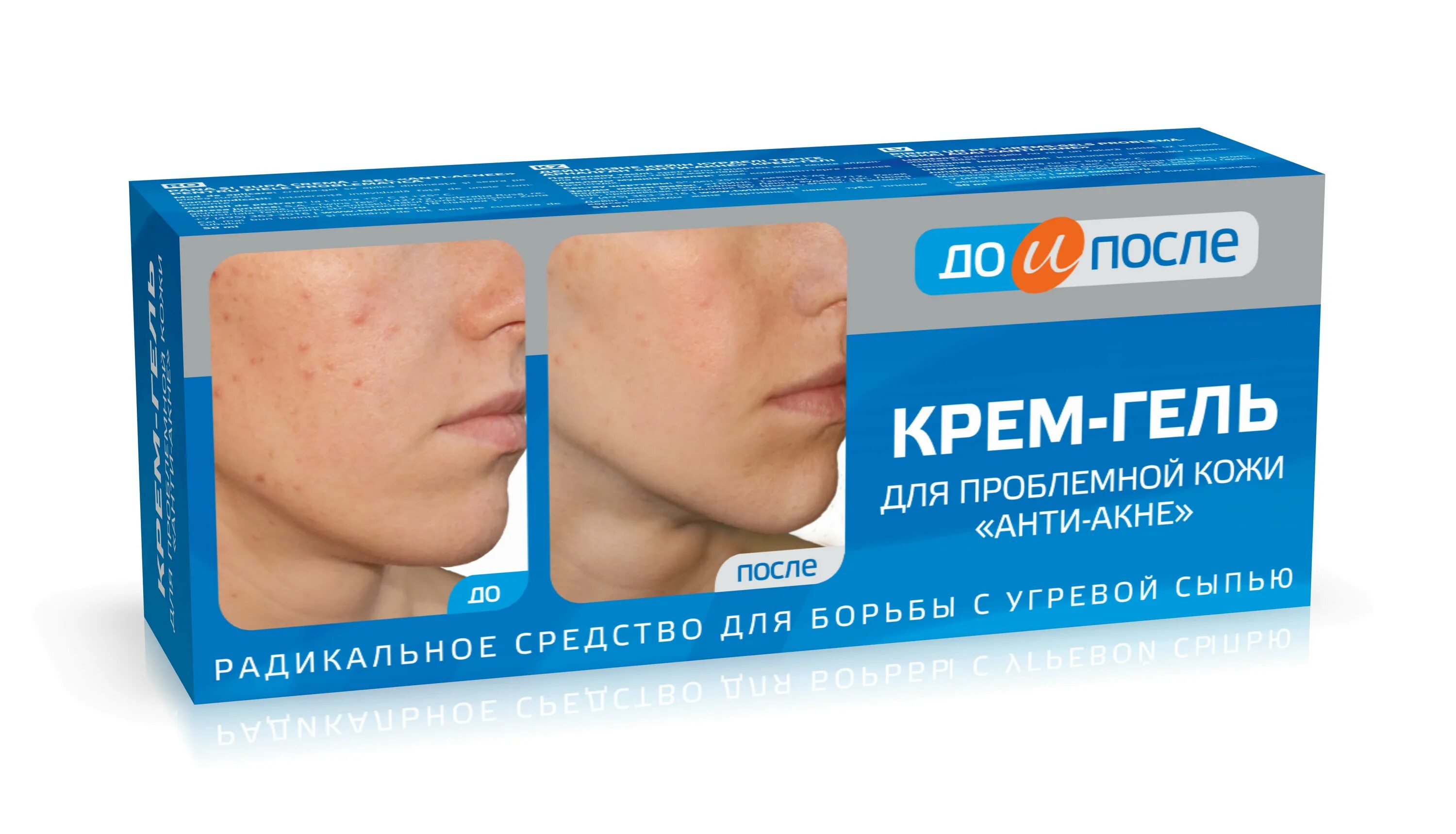 Средство от прыщей. Лучшее от угревой сыпи. Лучшее от угревой сыпи. Лучшее от угревой сыпи. Делекс акне форте гель.