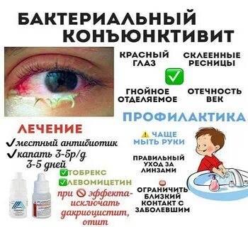 Как эффективно вылечить конъюнктивит