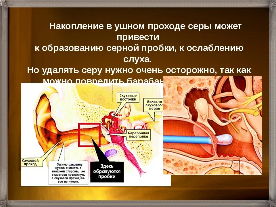 Залила ухо водой