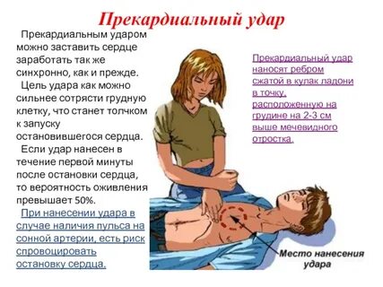 Нанесение прекардиального удара в область грудины