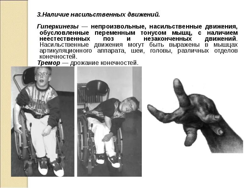 Непроизвольное движение мышц