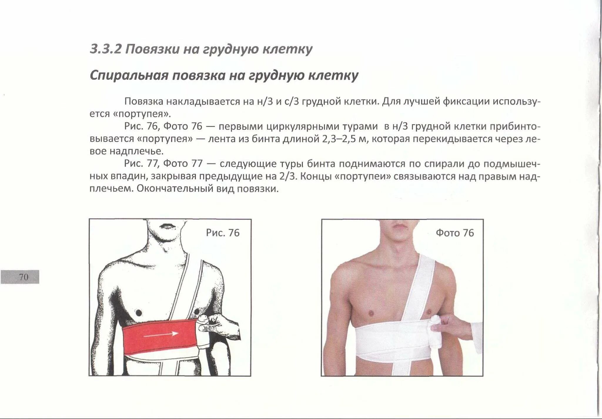 Повязка на грудную клетку алгоритм. Спиралевидная повязка на грудную клетку. Наложить повязку на грудную клетку. Наложение спиральной повязки на грудную клетку.