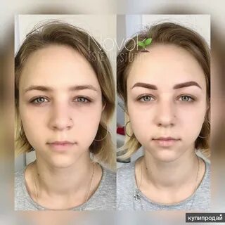 После натуральной
