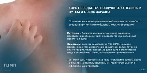 Корь заразна или нет
