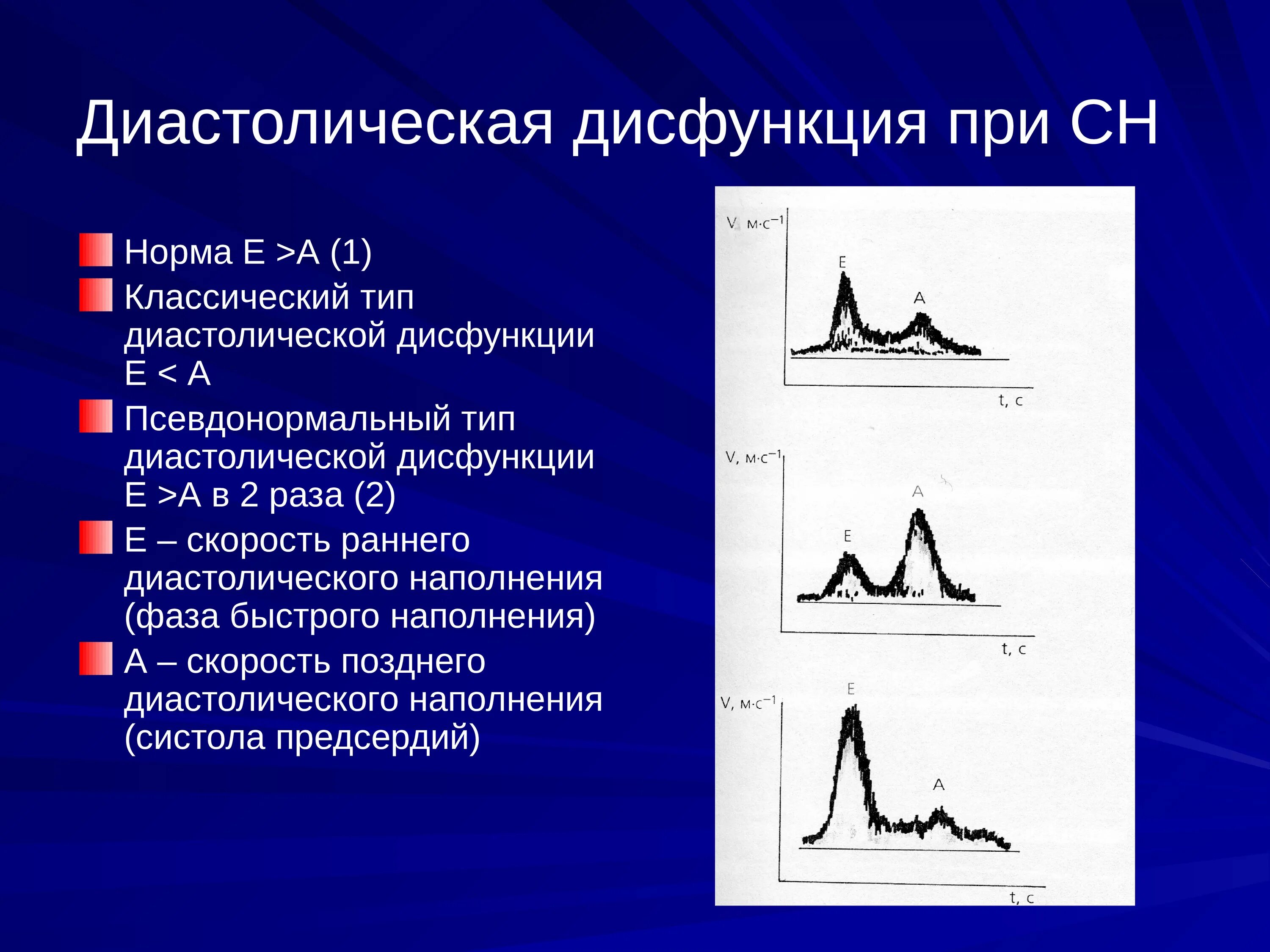 Степени диастолической дисфункции. Диастолическая функция е/а норма и 1 Тип. Типы нарушения диастолической функции лж. Диастолическая дисфункция левого желудочка е/а. УЗИ сердца диастолическая дисфункция.