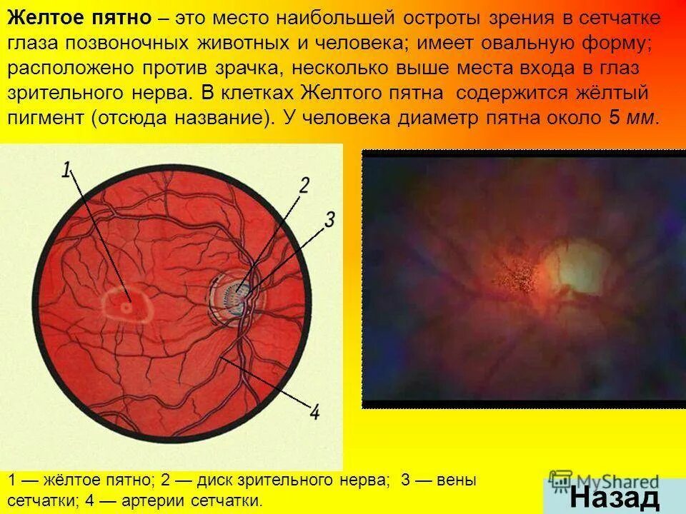 Слепое пятно находится в месте. Строение желтого пятна сетчатки. слепое и желтое пятно сетчатки глаза. желтое пятно сетчатки функции.