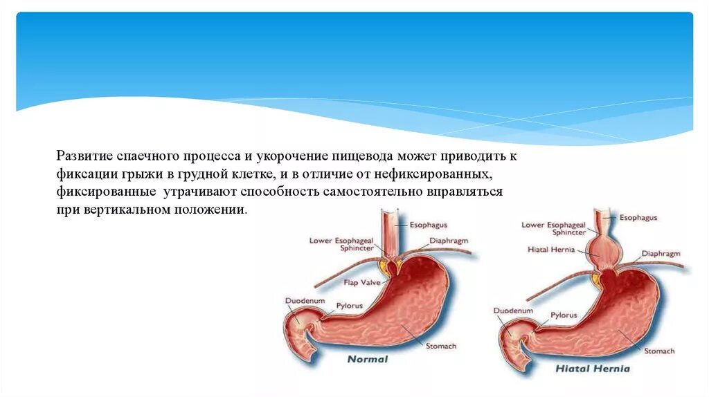 Пищевод процессы