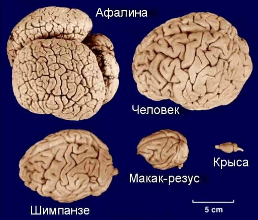 Размер мозга увеличивается. Размер мозга человека и дельфина. МОЗ Дельфин АИ человека. Мозг дельфина и мозг человека.