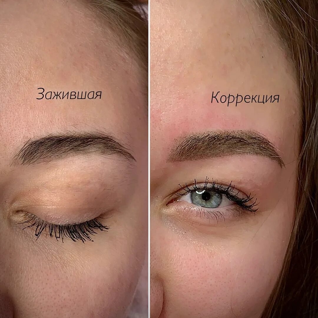На какой день после коррекции