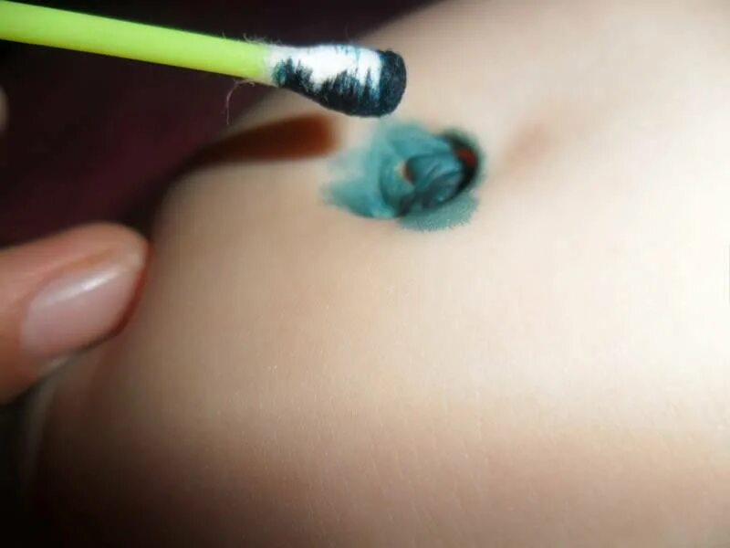 Можно обрабатывать пупок перекисью. Хлоргексидин для обработки кариозной полости. Препарат для обработки пупочной ранки. Можно обрабатывать пупок перекисью. Пупочная рана обработка ребенка;.