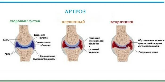 Синовиальная жидкость 2