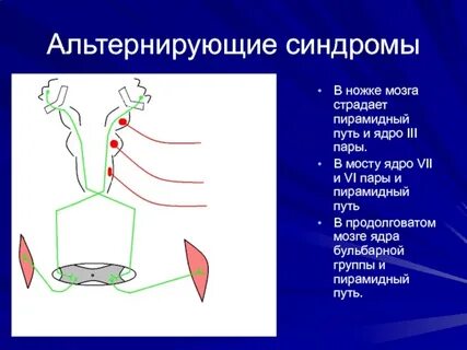 Альтернирующие вебера