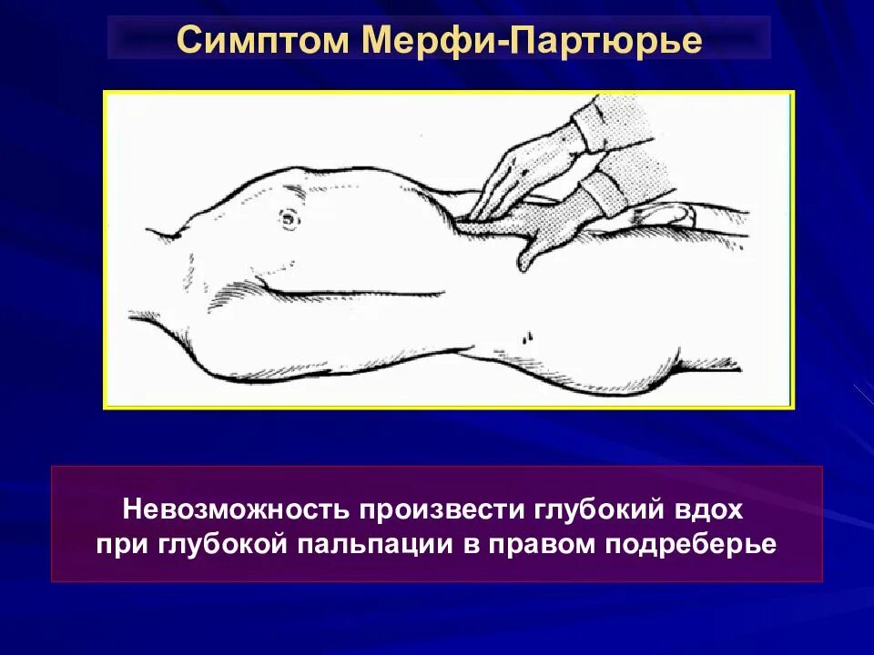 Что такое симптом. Симптомы кера мерфи ортнера. симптомы ортнера мерфи мюсси. симптомы кера, мерфи, мюсси-георгиевского, ортнера. симптом ортнера кера мюсси мерфи.