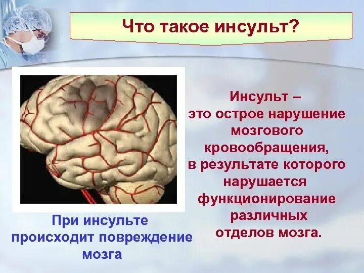 Инсульт органа. Острое нарушение мозгового кровообращения (ОНМК). Расстройства кровоснабжения головного мозга.