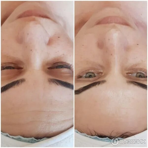 Фарфоровый пилинг. Фарфоровая кукла процедура для лица. Пилинг для лица. Фарфоровая кукла процедура. Фарфоровая кожа до и после.