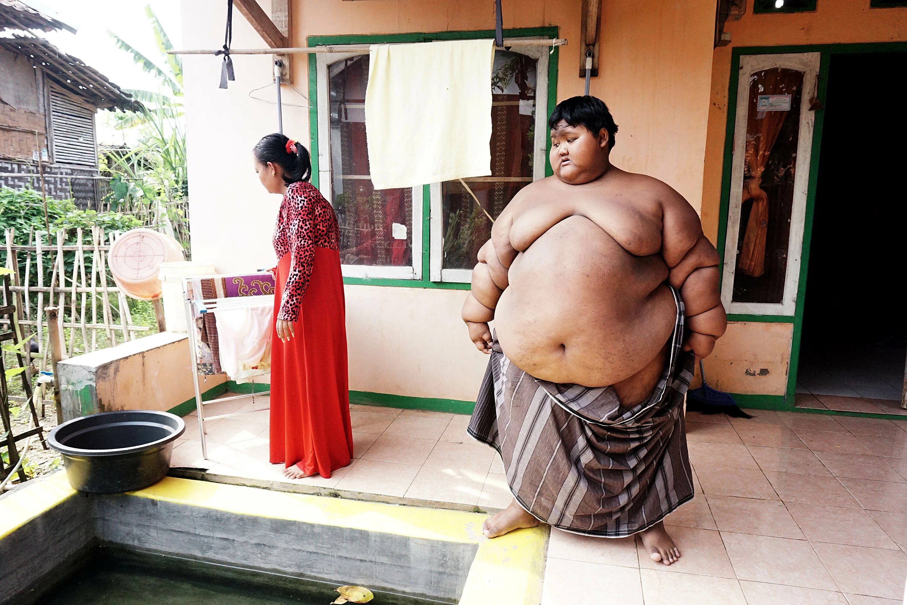 Толстый высокий мужчина. Самый толстый мальчик Арья Пермана. Арья перман мальчик из Индонезии. Самый толстый ребёнок в мире Арья.
