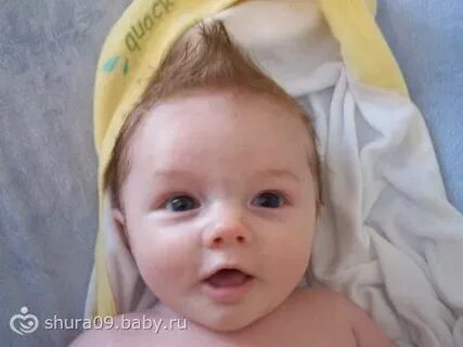 Отекла переносица у ребенка