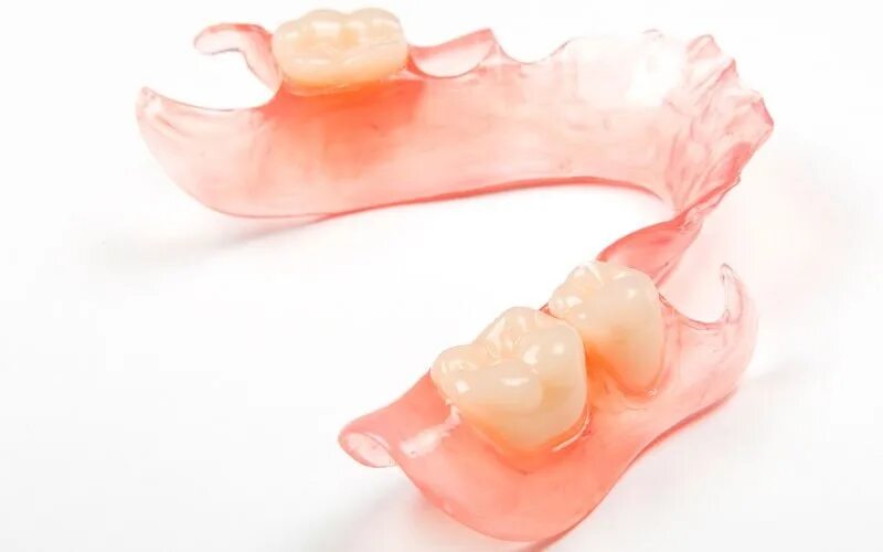 Съемный микропротез «бабочка». Микропротез бабочка на 1 зуб. Микропротез бабочка на 1. Микропротез бабочка на 1. Микропротез бабочка на 1.