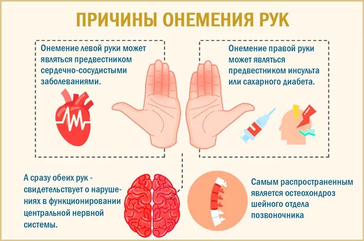 Сильно немеет левая. Почему немеют руки. Немеют руки причина. Онемение пальцев рук причины. Немеют пальцы на руках причины.