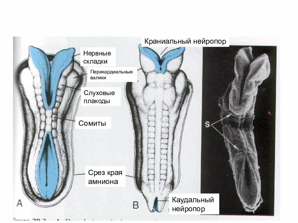 Процесс формирования нервной трубки. Плакоды нервной трубки. нейропор нервной трубки. краниальная часть нервной трубки.