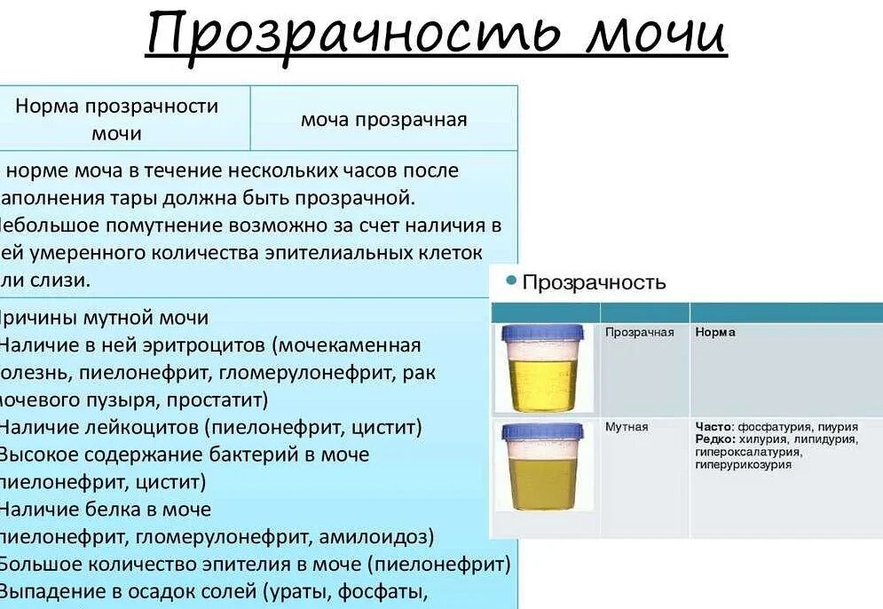 Причины помутнения мочи. Темный цвет мочи. Нормальный цвет мочи. Прозрачность мочи в норме.