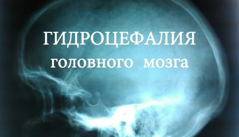Слово водянка. Слово водянка. Слово водянка. Слово водянка. Слово водянка.