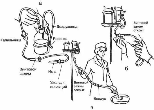 Как часто можно делать капельницы. Алгоритм внутривенного капельного введения лекарственных. Заполненниесистемы для капельного влмвания. Заполнение системы для внутривенного капельного вливания. Постановка капельницы алгоритм.