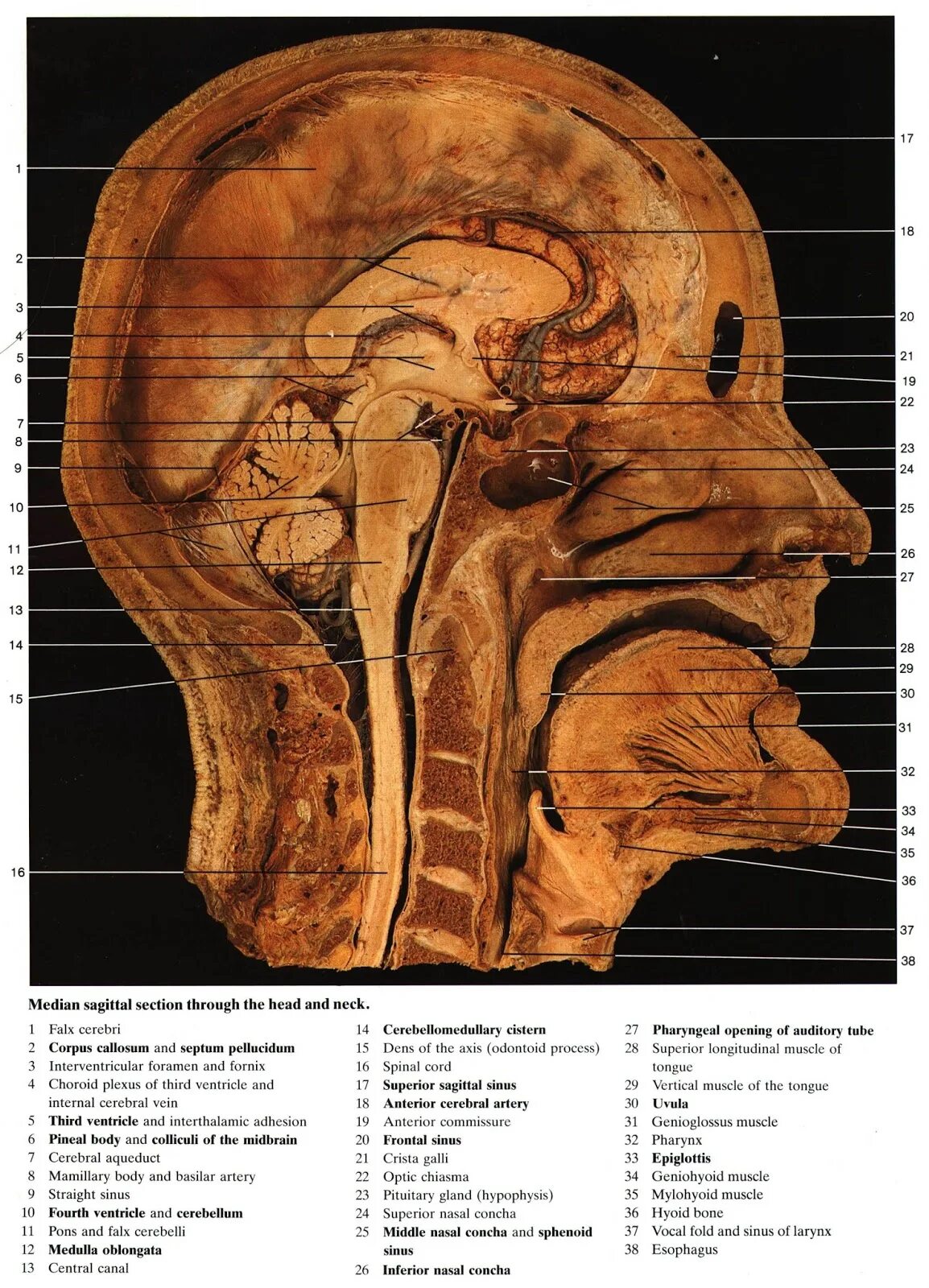 Sinus sagittalis superior