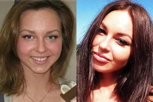 Бывшая участница "Дома-2" Анастасия Лисова показала, как выглядела до всех пласт