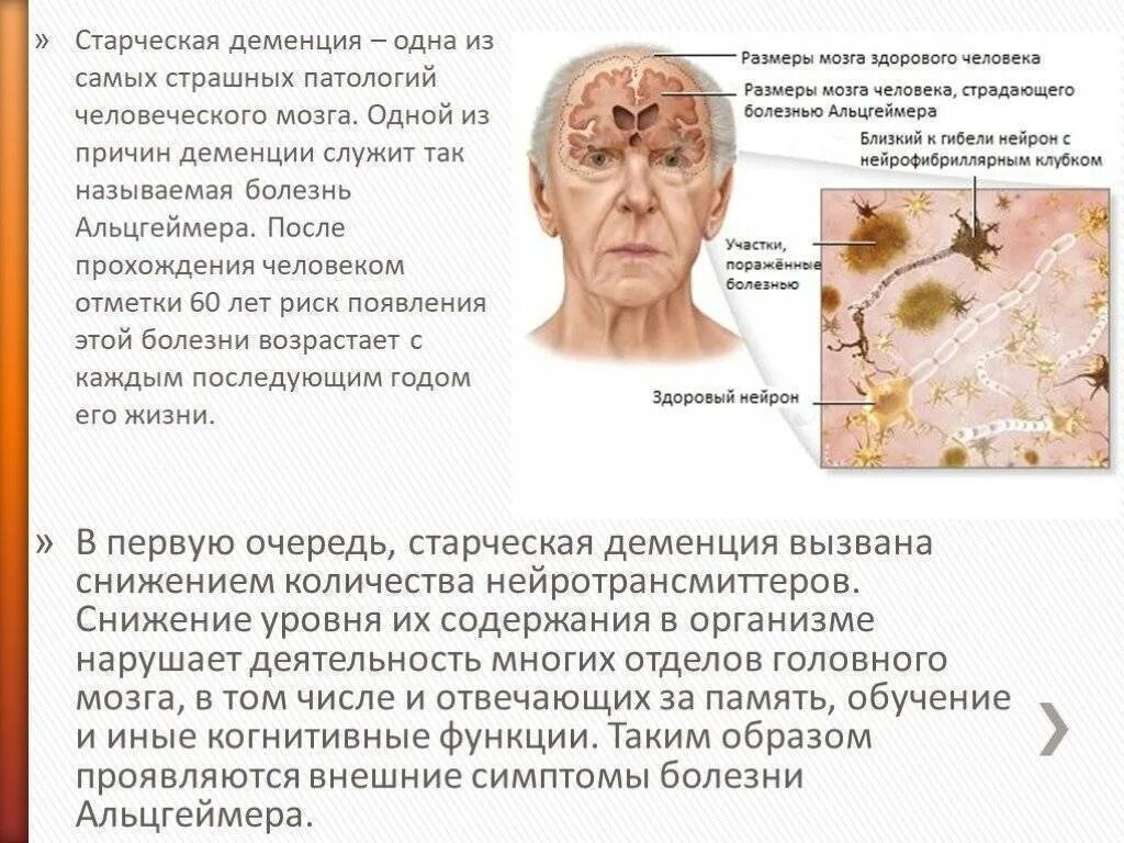 Деменция симптомы болезнь Альцгеймера симптомы. Сенильная деменция патогенез. Старческая деменция. Старческая деменция симптомы.