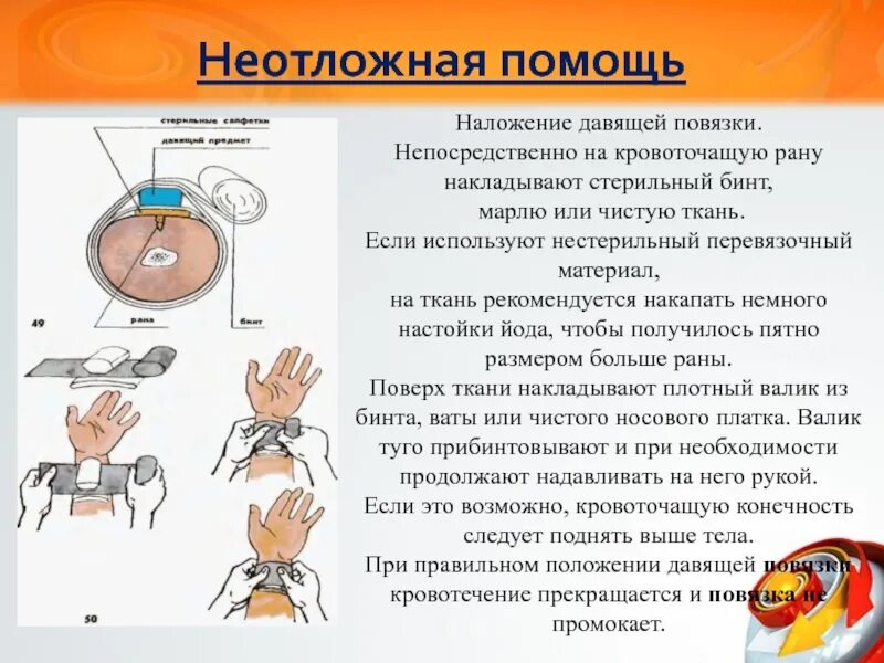 Что запрещается использовать в качестве давящей повязки. Наложение давящей повязки. наложение стерильной давящей повязки. давящая повязка на кровоточащую рану. последовательность наложения давящей повязки.