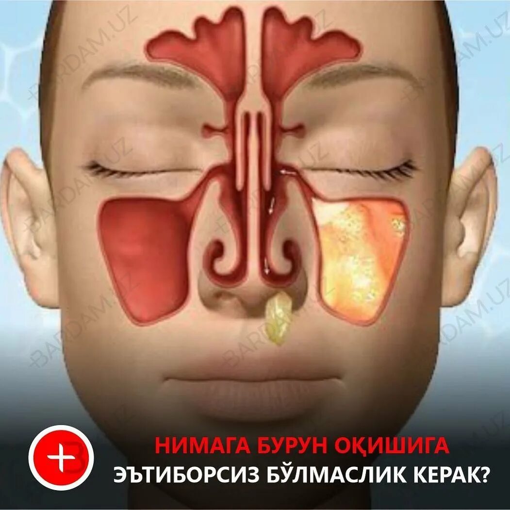 Гной в носу как называется. Гной в носу как называется