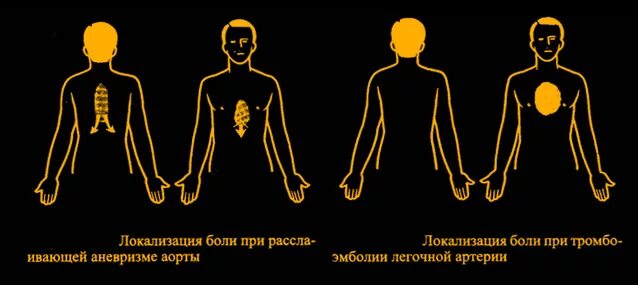 Болит солнечное сплетение. Боль в грудной клетке солнечное сплетение. Ноющая боль в области солнечного сплетения. Болит солнечное сплетение причины. Ноющая боль в солнечном