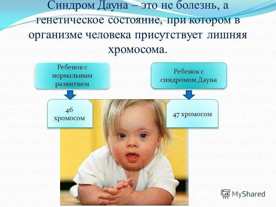 Развитие детей с синдромом Дауна. Дети с синдромом Дауна презентация. Памятка по синдрому Дауна. Особенности развития детей с синдромом Дауна. План дауна