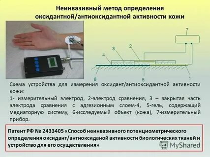 Метод активностей предложил