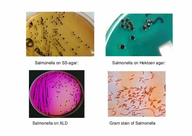 Spp salmonella spp shigella spp