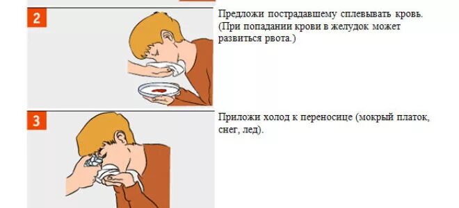 Если идет кровь из носа что делать. Носовое кровотечение первая помощь. Остановка носового кровотечения алгоритм. Идет кровь из носа как Остановить. Транспортное положение пострадавшего при носовом кровотечении.