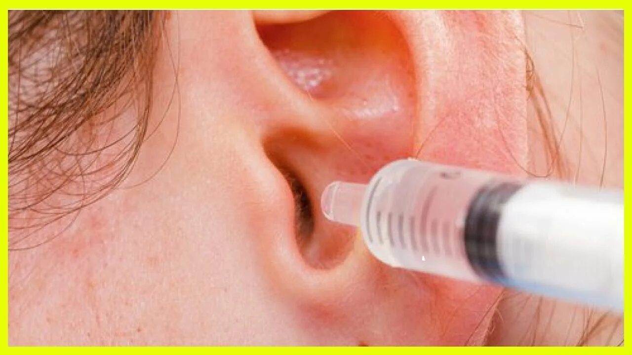 ушная пробка перекись водорода. шприц для промывания ушных пробок. можно ли перекисью промыть ухо от пробки. можно ли перекисью промыть ухо от пробки. можно ли перекисью промыть ухо от пробки.