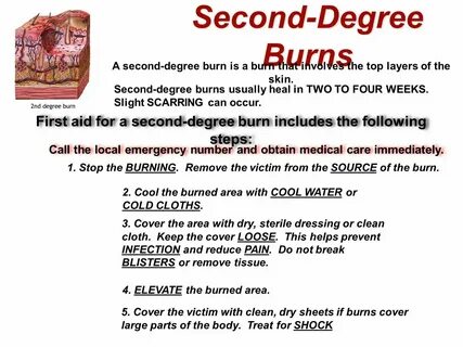 Burn burnt burnt неправильный