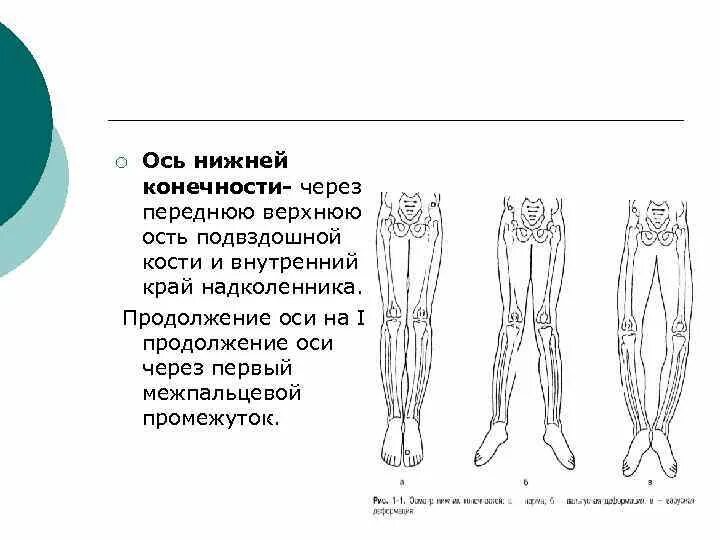 Измерение оси конечности травматология. Варусная деформация верхней конечности. Варусная деформация оси нижних конечностей. Ось нижней конечности.