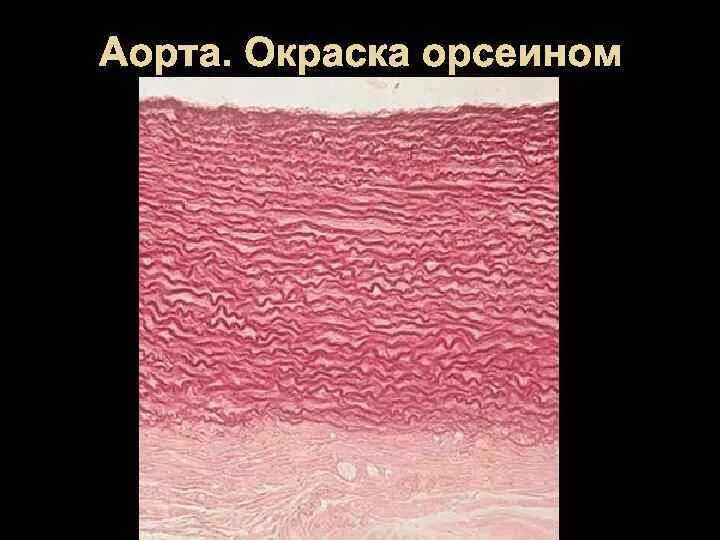 Артерия эластического типа препарат гистология. Аорта окраска орсеин гистология. артерия эластического типа аорта окраска орсеином. аорта орсеин гистология препарат. артерия эластического типа окраска орсеин.