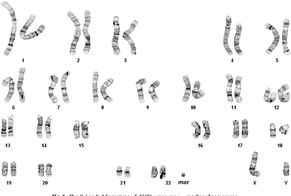 Хромосомы краба. Хромосомы Эворонской полевки. Хромосомы человека. Схема хромосомы человека.