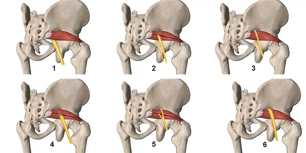 Мышца седалищного нерва. Грушевидная - Piriformis. Грушевидная мышца и седалищный нерв. Грушевидная мышца m. Piriformis. Седалищный нерв грушевидная анатомия.